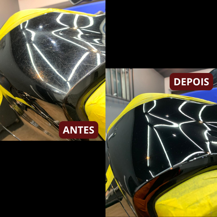 ANTES